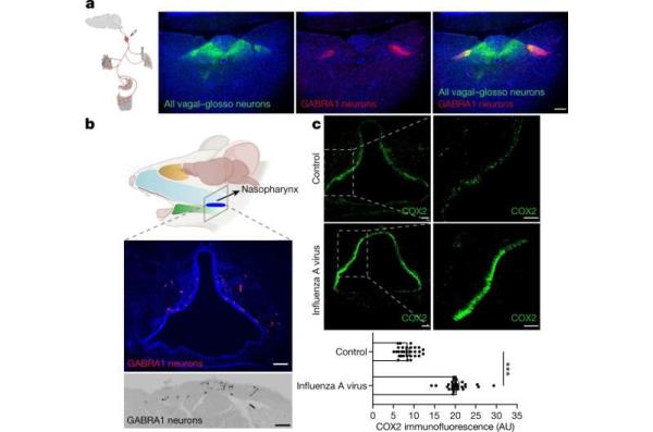 How the brain senses infection